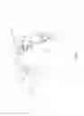 Fig. 03 - METHOD OF CLEANING AN ORAL APPLIANCE