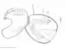 Fig. 04 - METHOD OF CLEANING AN ORAL APPLIANCE