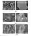 Fig. 02 - DIRECTLY COMPRESSIBLE GRANULAR MICROCRYSTALLINE CELLULOSE BASED EXCIPIENT, MANUFACTURING PROCESS AND USE THEREOF