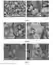 Fig. 03 - DIRECTLY COMPRESSIBLE GRANULAR MICROCRYSTALLINE CELLULOSE BASED EXCIPIENT, MANUFACTURING PROCESS AND USE THEREOF