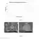 Fig. 07 - DIRECTLY COMPRESSIBLE GRANULAR MICROCRYSTALLINE CELLULOSE BASED EXCIPIENT, MANUFACTURING PROCESS AND USE THEREOF