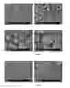 Fig. 08 - DIRECTLY COMPRESSIBLE GRANULAR MICROCRYSTALLINE CELLULOSE BASED EXCIPIENT, MANUFACTURING PROCESS AND USE THEREOF