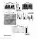 Fig. 09 - METHODS OF TREATING AUTOPHAGY-ASSOCIATED DISORDERS AND RELATED PHARMACEUTICAL COMPOSITIONS, DIAGNOSTICS, SCREENING TECHNIQUES AND KITS