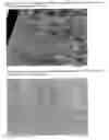 Fig. 09 - Pharmaceutical preparation containing oxycodone and naloxone
