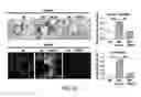 Fig. 28 - Treatment of GVHD