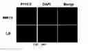 Fig. 27 - Therapies for hematologic malignancies