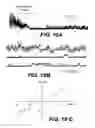 Fig. 14 - NOVEL NON-SELECTIVE CATION CHANNEL IN NEURONAL CELLS AND METHODS FOR TREATING BRAIN SWELLING