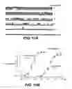 Fig. 15 - NOVEL NON-SELECTIVE CATION CHANNEL IN NEURONAL CELLS AND METHODS FOR TREATING BRAIN SWELLING