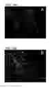 Fig. 31 - NOVEL NON-SELECTIVE CATION CHANNEL IN NEURONAL CELLS AND METHODS FOR TREATING BRAIN SWELLING