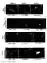 Fig. 33 - NOVEL NON-SELECTIVE CATION CHANNEL IN NEURONAL CELLS AND METHODS FOR TREATING BRAIN SWELLING
