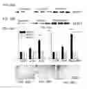 Fig. 37 - NOVEL NON-SELECTIVE CATION CHANNEL IN NEURONAL CELLS AND METHODS FOR TREATING BRAIN SWELLING