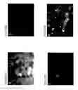 Fig. 40 - NOVEL NON-SELECTIVE CATION CHANNEL IN NEURONAL CELLS AND METHODS FOR TREATING BRAIN SWELLING