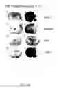 Fig. 53 - NOVEL NON-SELECTIVE CATION CHANNEL IN NEURONAL CELLS AND METHODS FOR TREATING BRAIN SWELLING