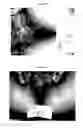 Fig. 07 - Therapeutic Methods And Pharmaceutical Compositions For Treating Warts With Tellurium Compounds