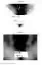 Fig. 08 - Therapeutic Methods And Pharmaceutical Compositions For Treating Warts With Tellurium Compounds