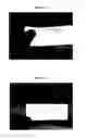 Fig. 11 - Therapeutic Methods And Pharmaceutical Compositions For Treating Warts With Tellurium Compounds