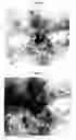 Fig. 12 - Therapeutic Methods And Pharmaceutical Compositions For Treating Warts With Tellurium Compounds