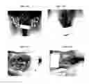 Fig. 17 - Therapeutic Methods And Pharmaceutical Compositions For Treating Warts With Tellurium Compounds