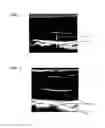 Fig. 02 - METHOD FOR THE ATTENUATION OF ATHEROSCLEROSIS CONDITION(S) USING LICORICE EXTRACT AS A MEDICAMENT