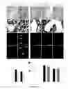 Fig. 03 - Systemic gene replacement therapy for treatment of X-linked myotubular myopathy (XLMTM)