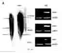 Fig. 05 - Systemic gene replacement therapy for treatment of X-linked myotubular myopathy (XLMTM)