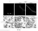 Fig. 09 - Systemic gene replacement therapy for treatment of X-linked myotubular myopathy (XLMTM)