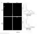 Fig. 10 - Systemic gene replacement therapy for treatment of X-linked myotubular myopathy (XLMTM)