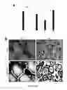 Fig. 12 - Systemic gene replacement therapy for treatment of X-linked myotubular myopathy (XLMTM)