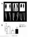 Fig. 15 - Systemic gene replacement therapy for treatment of X-linked myotubular myopathy (XLMTM)