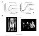 Fig. 17 - Systemic gene replacement therapy for treatment of X-linked myotubular myopathy (XLMTM)
