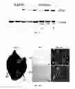 Fig. 18 - Systemic gene replacement therapy for treatment of X-linked myotubular myopathy (XLMTM)