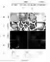 Fig. 23 - Systemic gene replacement therapy for treatment of X-linked myotubular myopathy (XLMTM)