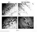 Fig. 27 - Systemic gene replacement therapy for treatment of X-linked myotubular myopathy (XLMTM)
