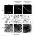 Fig. 29 - Systemic gene replacement therapy for treatment of X-linked myotubular myopathy (XLMTM)