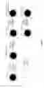 Fig. 02 - Detection and treatment of caries and microcavities with nanoparticles