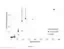 Fig. 16 - Detection and treatment of caries and microcavities with nanoparticles