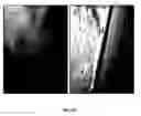 Fig. 09 - Porous polymer scaffold useful for tissue engineering in stem cell transplantation