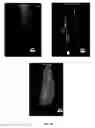 Fig. 12 - Porous polymer scaffold useful for tissue engineering in stem cell transplantation