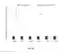 Fig. 13 - Porous polymer scaffold useful for tissue engineering in stem cell transplantation
