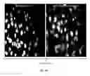 Fig. 19 - Porous polymer scaffold useful for tissue engineering in stem cell transplantation