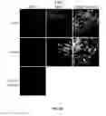 Fig. 33 - Porous polymer scaffold useful for tissue engineering in stem cell transplantation