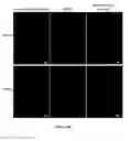 Fig. 45 - Porous polymer scaffold useful for tissue engineering in stem cell transplantation