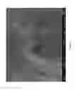 Fig. 16 - Human liver scaffolds