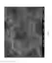 Fig. 18 - Human liver scaffolds