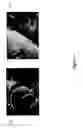 Fig. 06 - Cell bandage