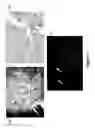 Fig. 07 - Cell bandage