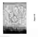 Fig. 11 - Cell bandage