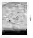 Fig. 15 - Cell bandage