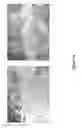 Fig. 17 - Cell bandage