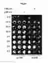 Fig. 09 - DERIVATION OF FIBROCHONDROCYTES FROM PROGENITOR CELLS